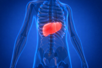 Was ist eine Fettleber? Ursachen, Symtpome und Behandlung