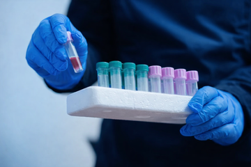 Fettleber Blutwerte: Leberwerte richtig verstehen + FLI Rechner